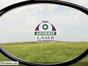 zel Akdeniz Lazer Gz Merkezi